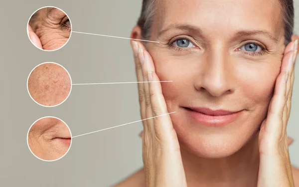 skin aging examples